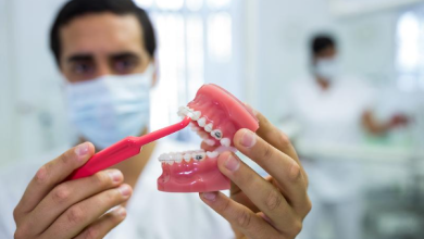 Orthodontist Insights into Common Bite Problems and Solutions