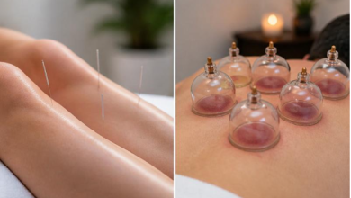 4 Differences Between TCM Weight Loss and Cupping Slimming